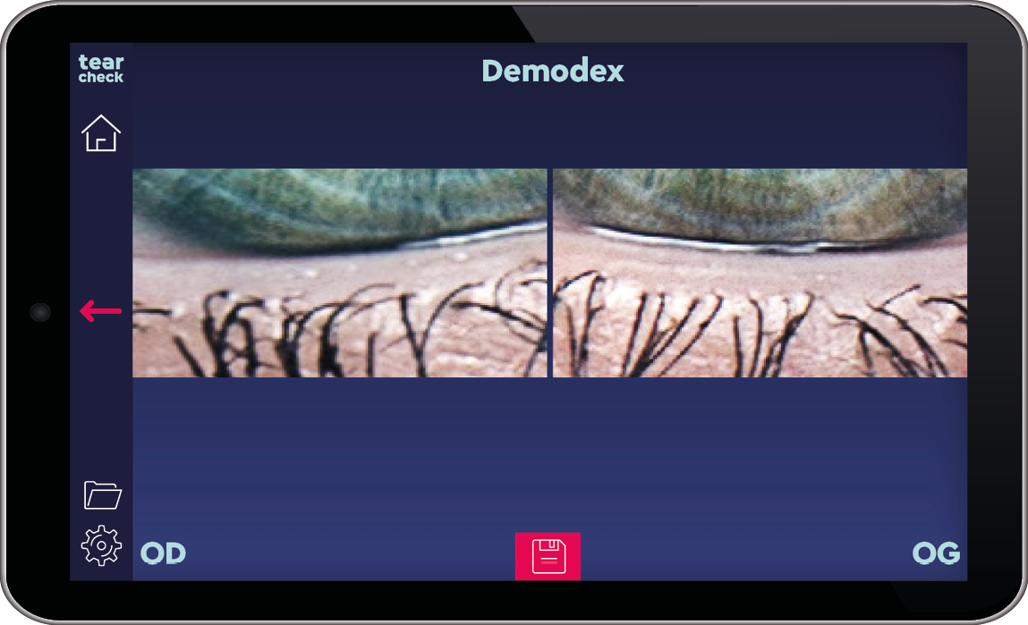 Demodex