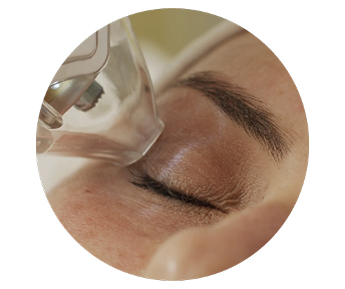 Dry Eye Relief in 2 Minutes